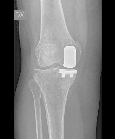 RADIOGRAFIA POSTOPERATORIA 1