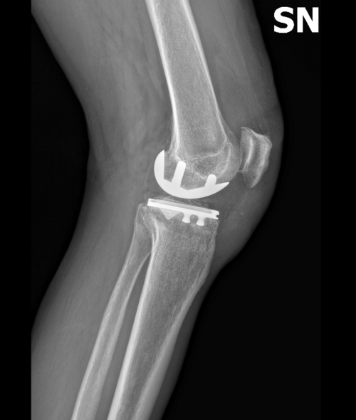 RADIOGRAFIA POSTOPERATORIA 2