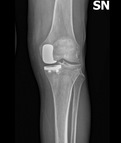 RADIOGRAFIA POSTOPERATORIA