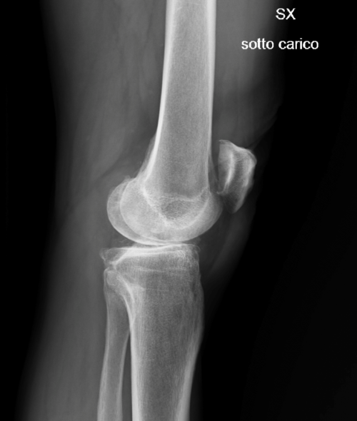 RADIOGRAFIA PREOPERATORIA 2