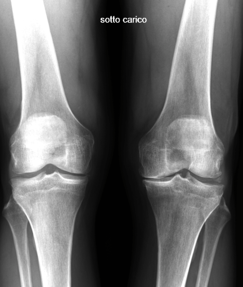 RADIOGRAFIA PREOPERATORIA