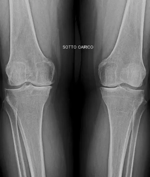 RADIOGRAFIA PROPERATORIA 1